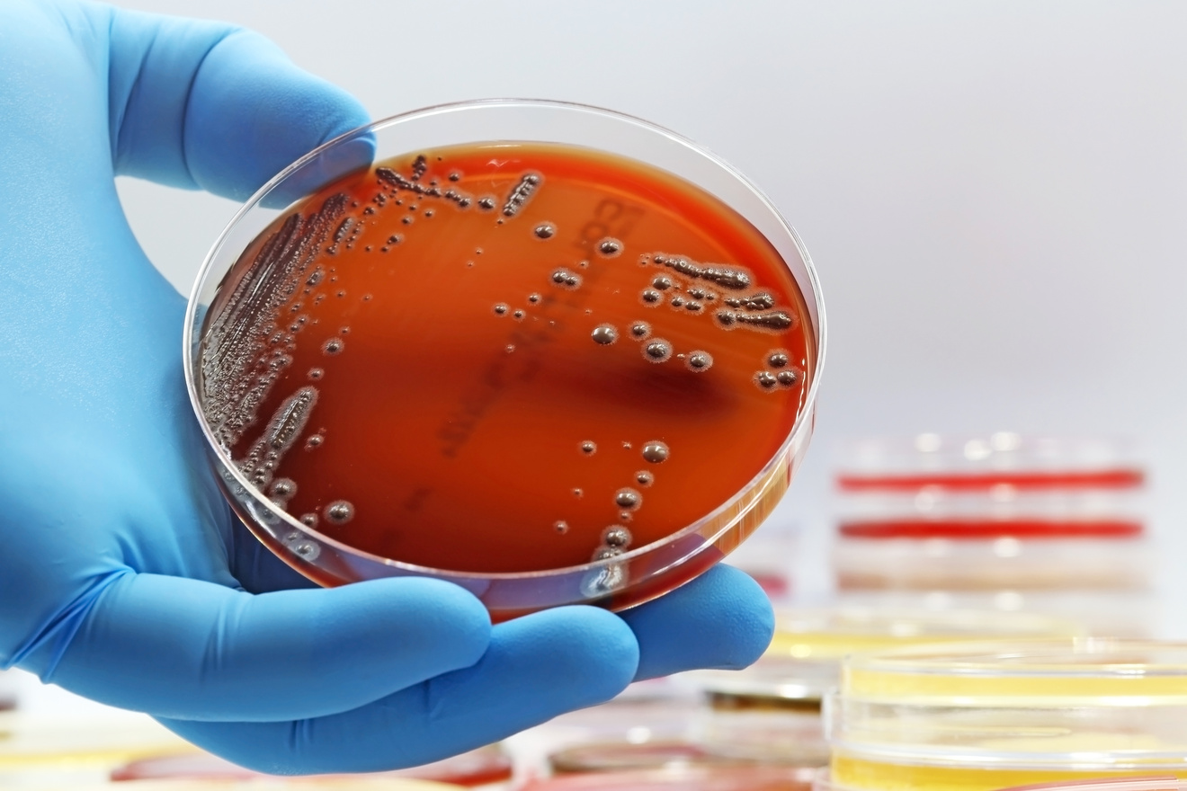 a hand holding a petri dish with red liquid in it. a scientist working on some food samples